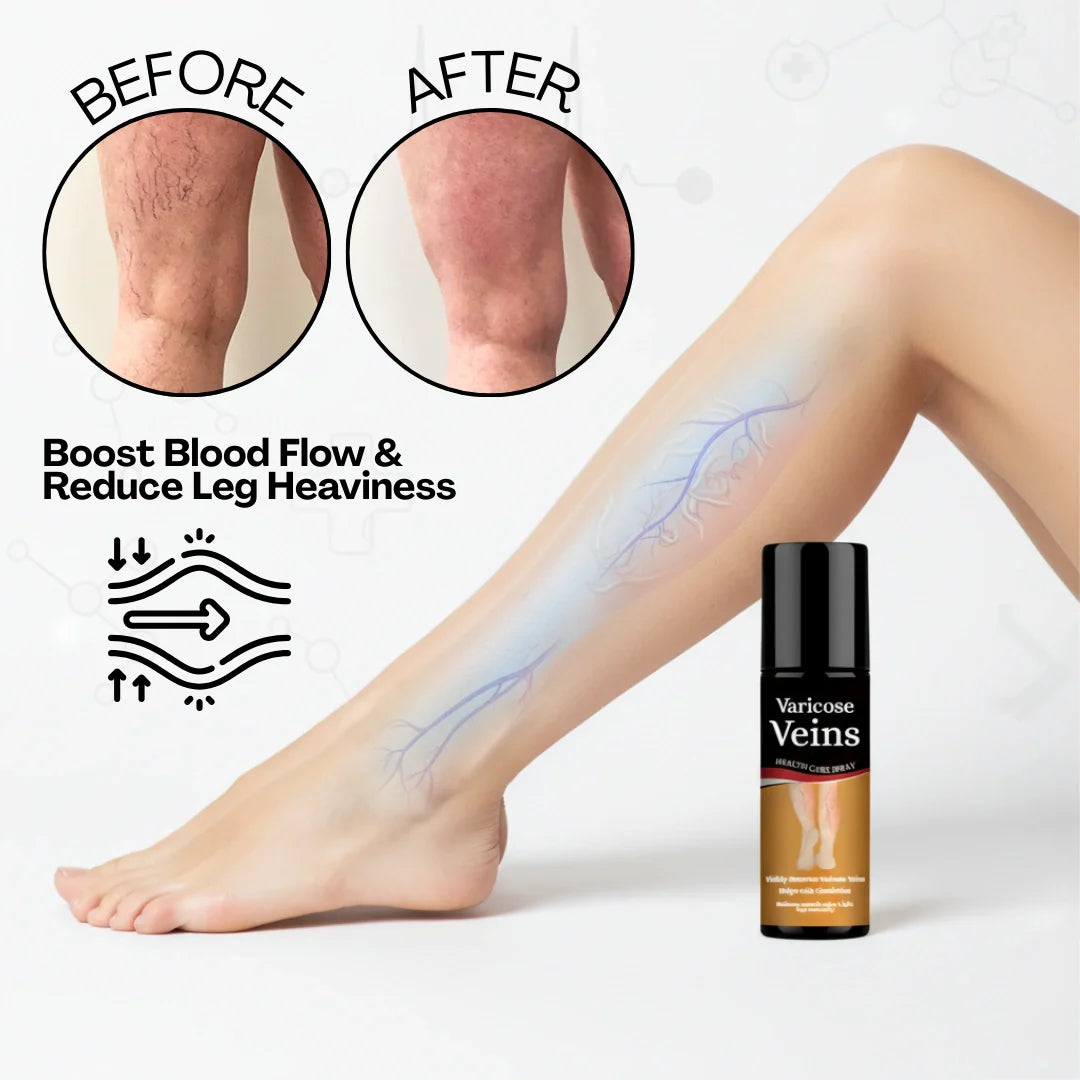Varicose Vein Spray Leg Pain Gone, Confidence On
